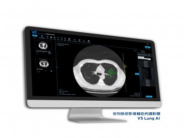 倍利半導體晶圓瑕疵檢測AI技術跨足醫療 取得台灣衛福部第一張上市許可證