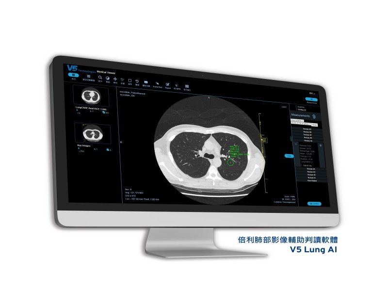 倍利半導體晶圓瑕疵檢測AI技術跨足醫療 取得台灣衛福部第一張上市許可證。（廠商提供）