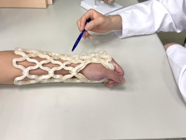 華宇藥新型自塑科技石膏 CASTOMIZE創新骨折輔具搶先上市