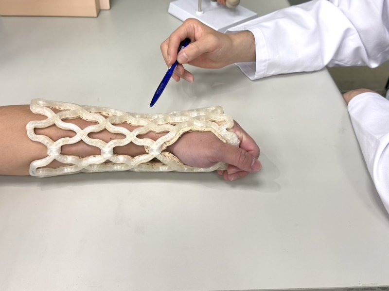 華宇藥新型自塑科技石膏 CASTOMIZE創新骨折輔具搶先上市。(華宇藥提供)